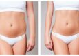 TruSculpt