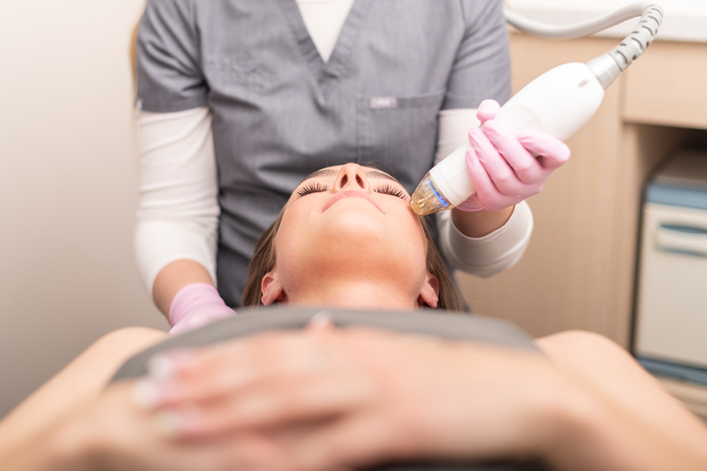Laser Treatments