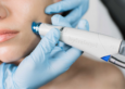 hydrafacial