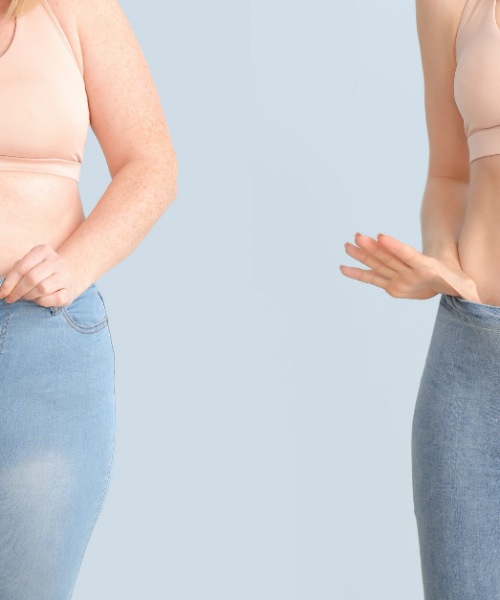 CoolSculpting | Dolce Vita Wellness Spa